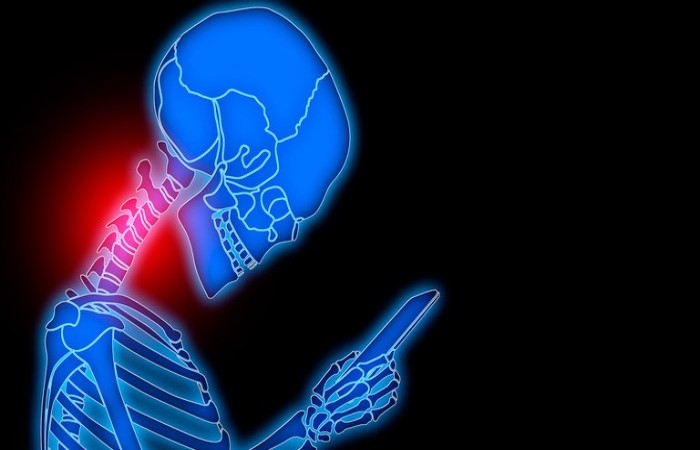 Síndrome del text neck