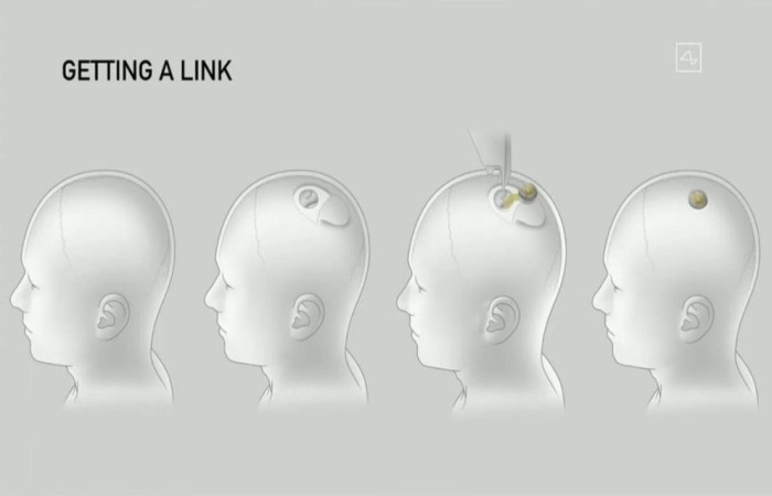 Como funciona el Neuralink